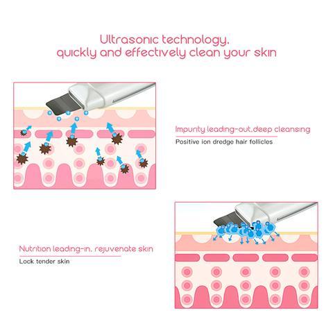 Ultrasonic Skin Scrubber Face